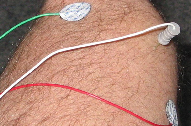 Electromiograma